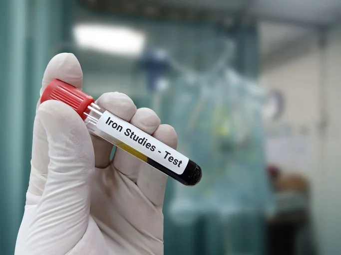 Why Your Hemoglobin Can Be Normal While Your Iron Stores Are Empty