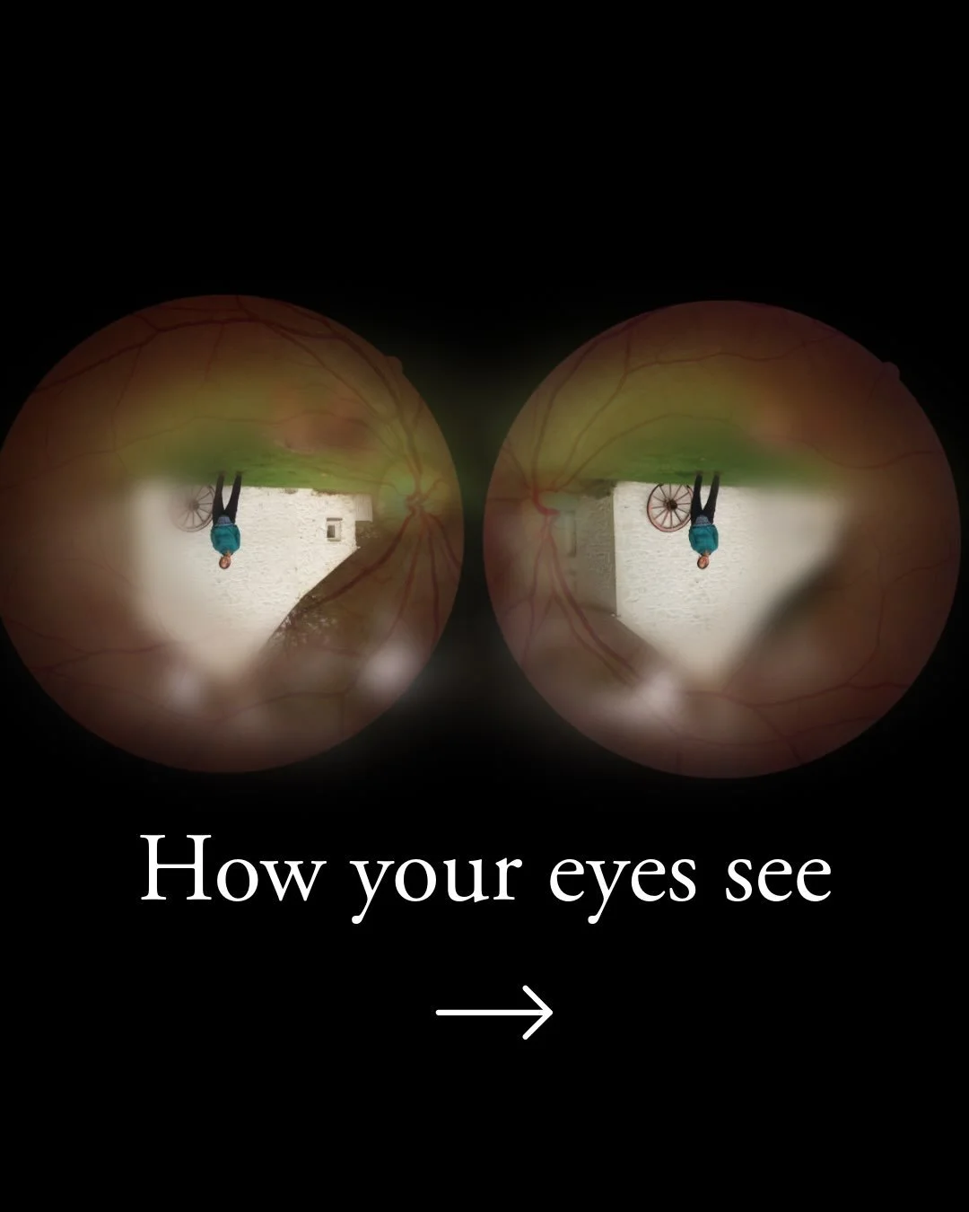 Your mind is so powerful&hellip;.it takes the LIMITED signals we receive from our eyes and creates the beautiful world we see around us:&nbsp;

👁️ Your eyes are only capable of 20/20 Vision at a tiny 1.5mm spot on the retina called the Fovea Central