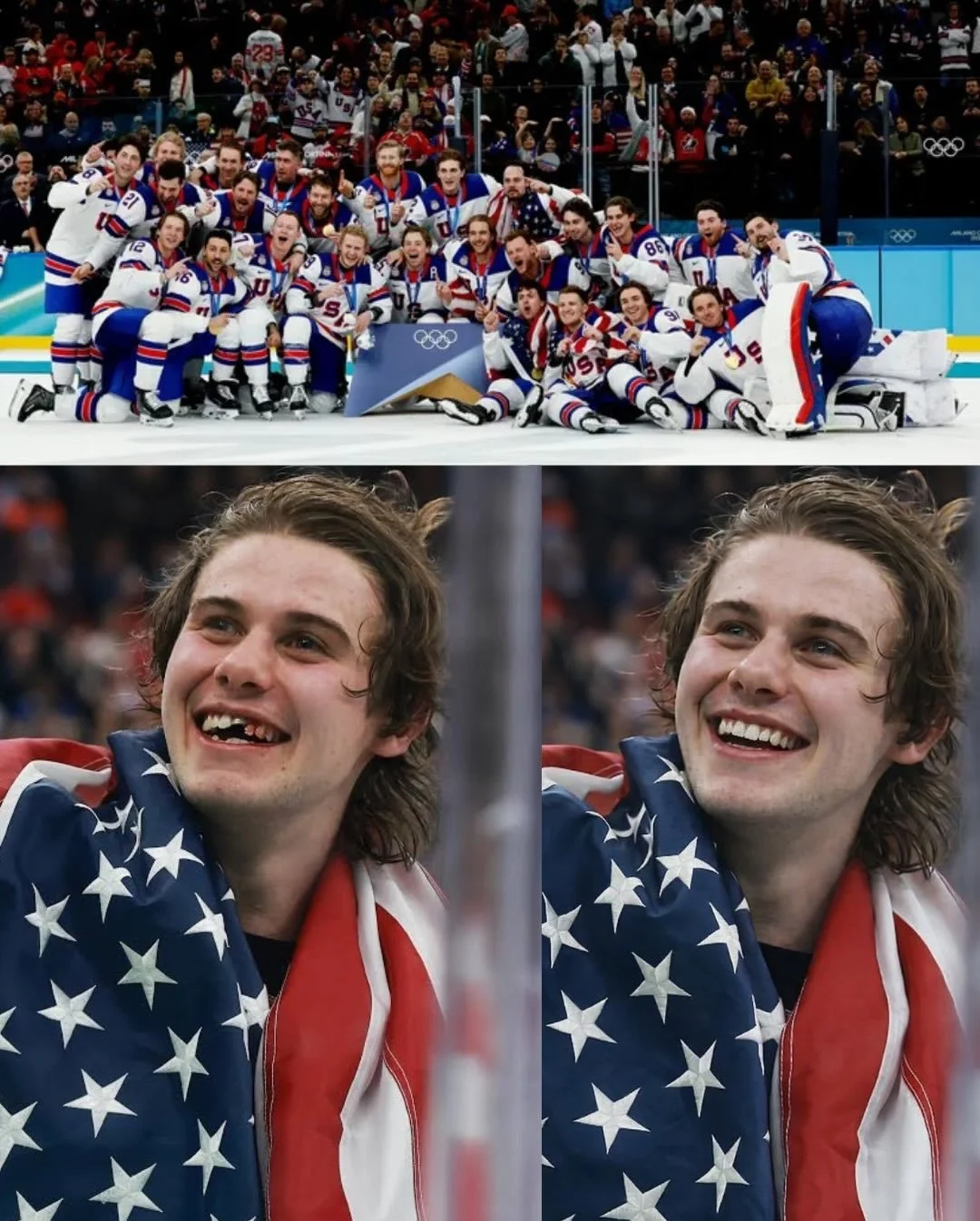 Due to American golden boy, Jack Hughes&rsquo; dental emergency in Italy&hellip; as well as the impending Nor&rsquo;Easter, our office will be closed tomorrow, February 23rd. Congrats to team USA on gold! Stay safe everyone, try not to slip and fall 
