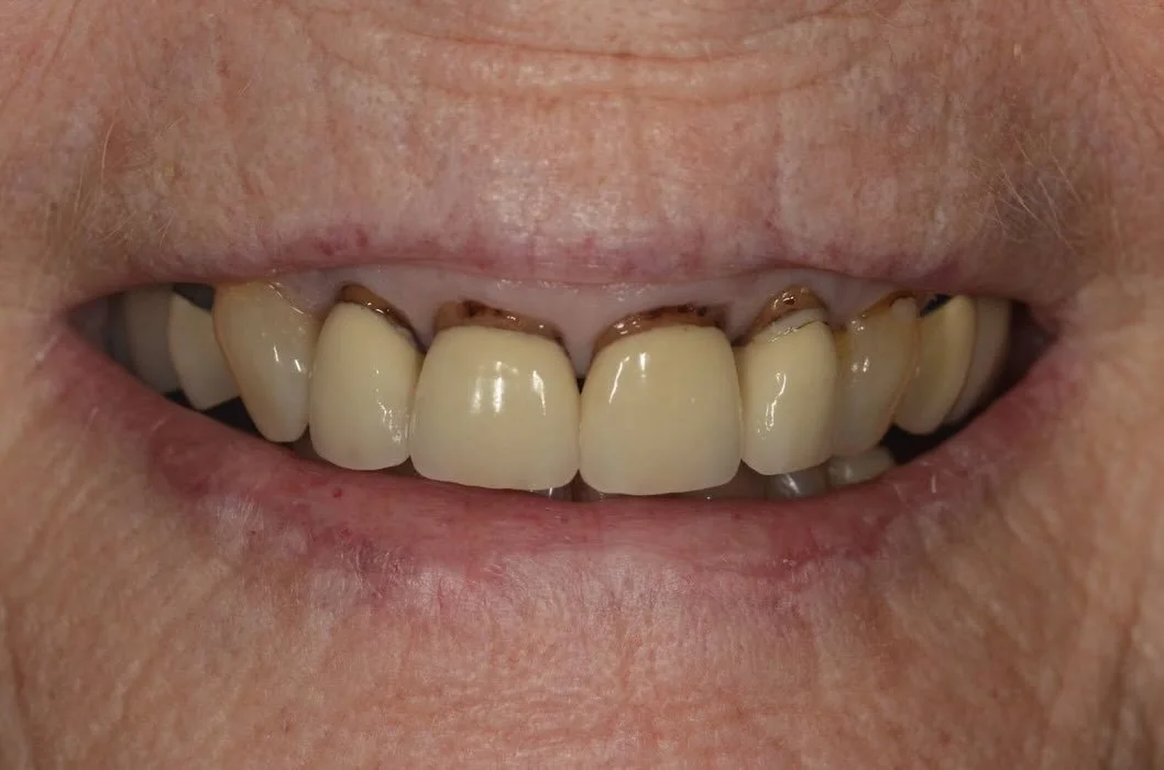 Where dentistry meets artistry ✨
Swipe for the before &amp; after ➡️