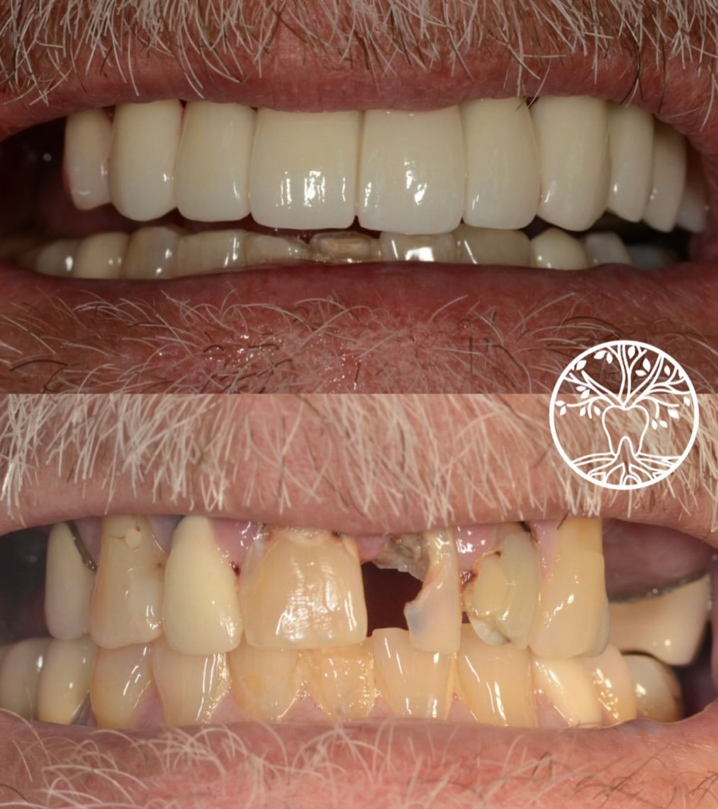 Smile transformations aren&rsquo;t just cosmetic - they&rsquo;re functional, personalized, and life-changing.

Every detail is designed with you in mind. 🌿✨🦷