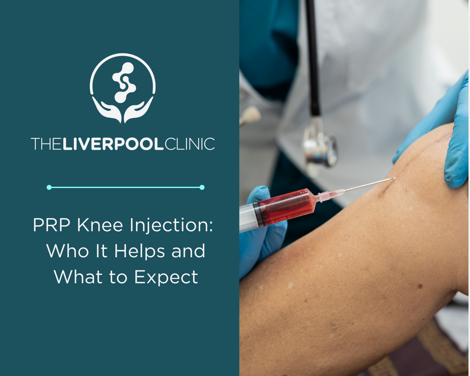 PRP Injections for Knee Pain: Who It Helps and What to Expect