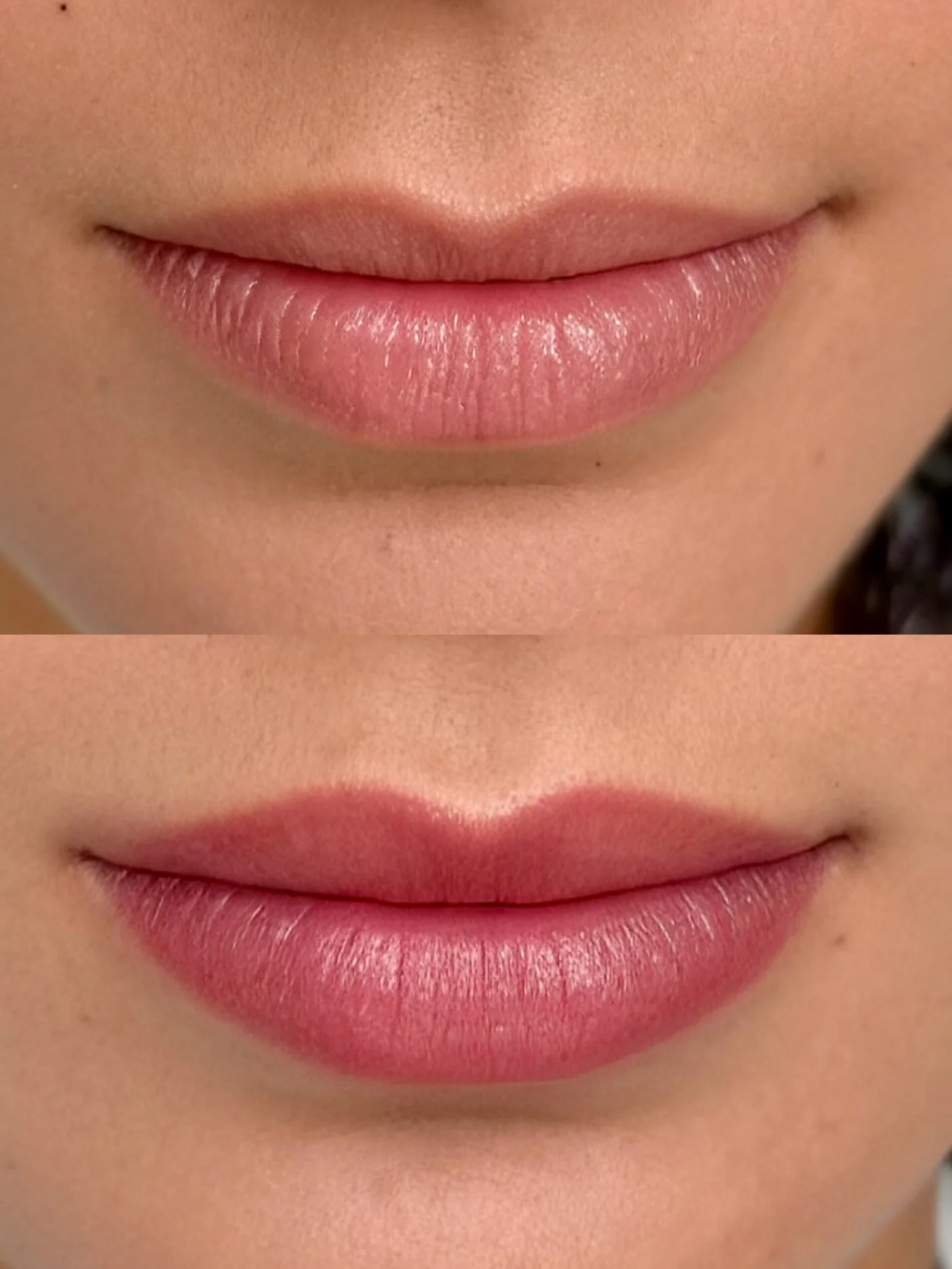 Where Did My Lip Line Go? How Lip Blushing Restores Faded Color and Definition