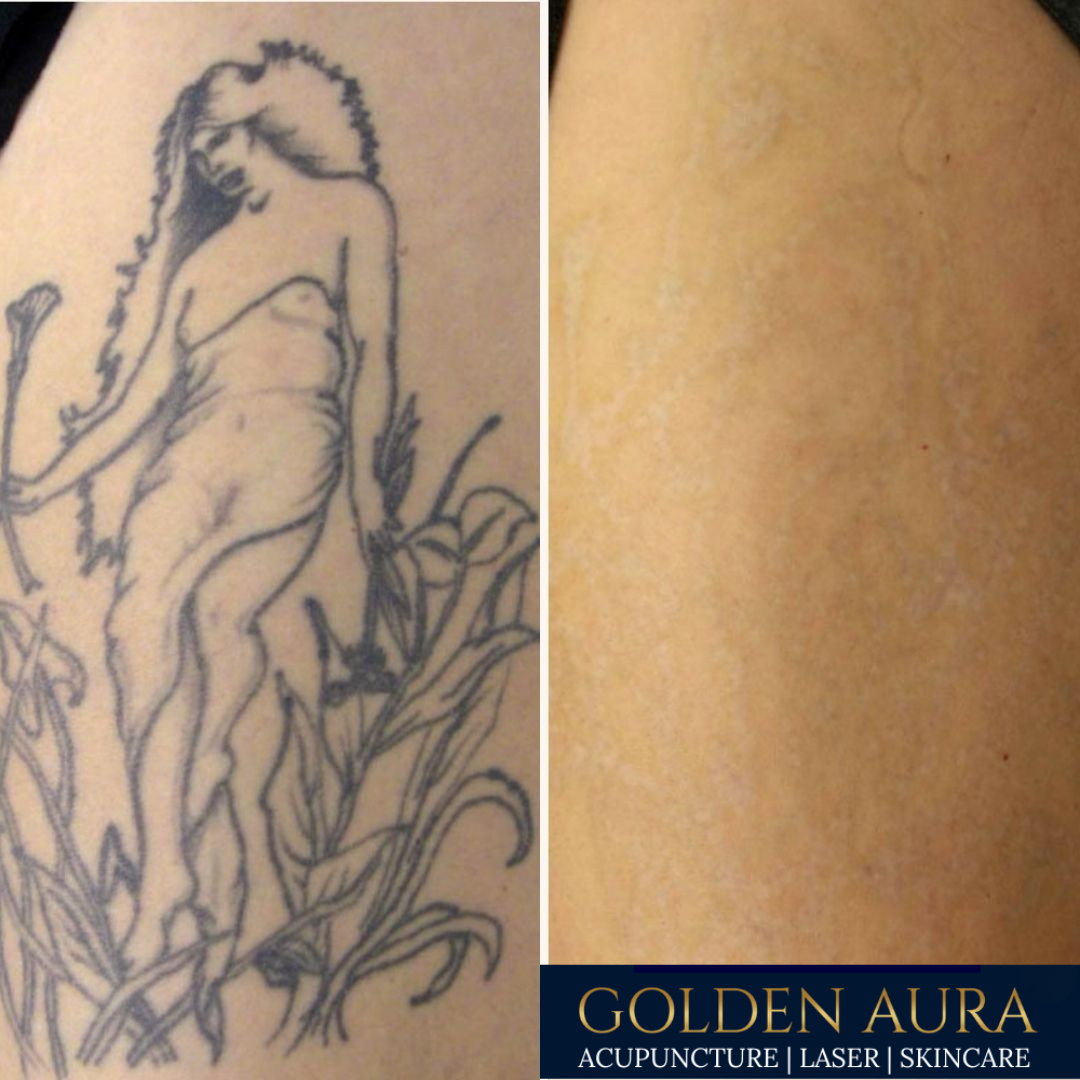 LTR before and after2.png