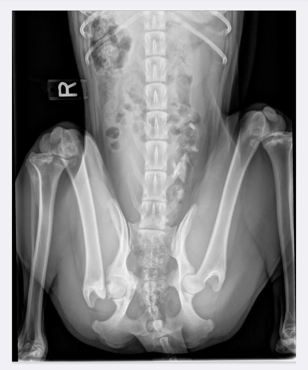 Robyn pre sx_post accident x ray.jpg