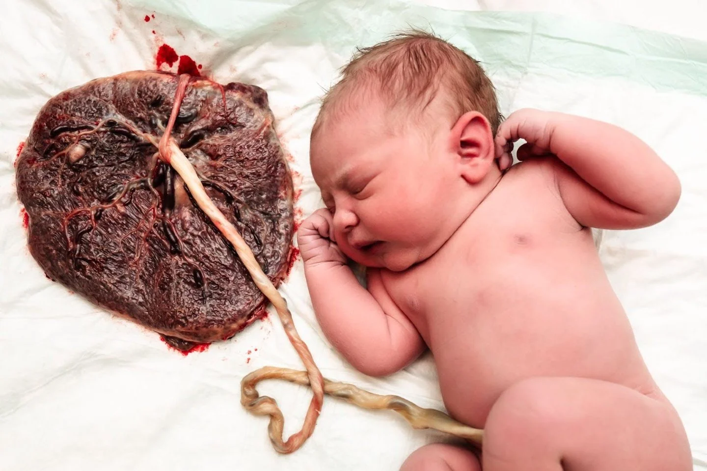 Let&rsquo;s talk about the placenta after a home birth.
In my care, we honor the natural rhythm of the third stage. That means we wait for your placenta to be born in its own timing. During this time, your baby stays skin-to-skin with you, the cord i