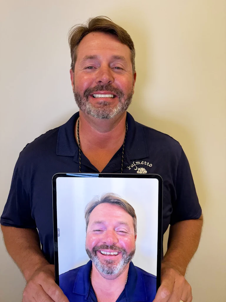 Premier-Smile-Pawleys-Gallery-4.png