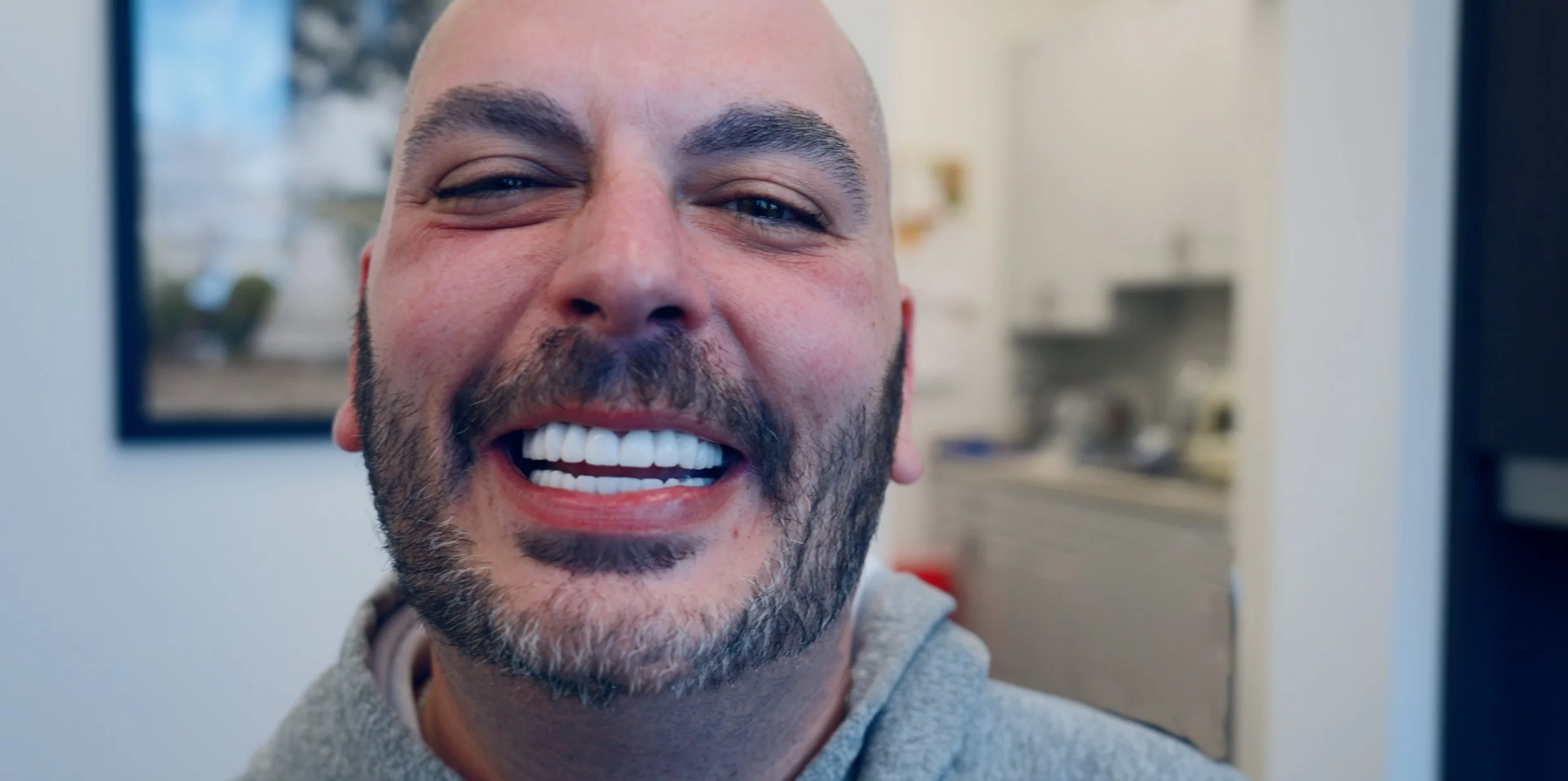 Case Study: “My Smile is My Money Maker”