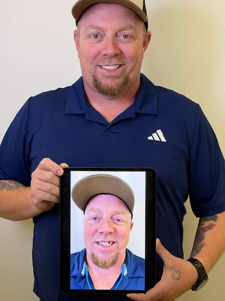 Premier-Smile-Pawleys-Gallery-6.png