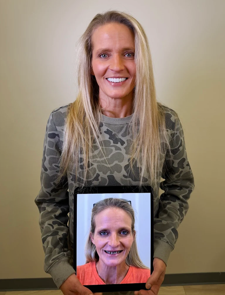 Premier-Smile-Pawleys-Gallery-14.png