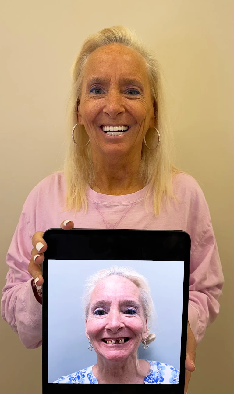 Premier-Smile-Pawleys-Gallery-8.png