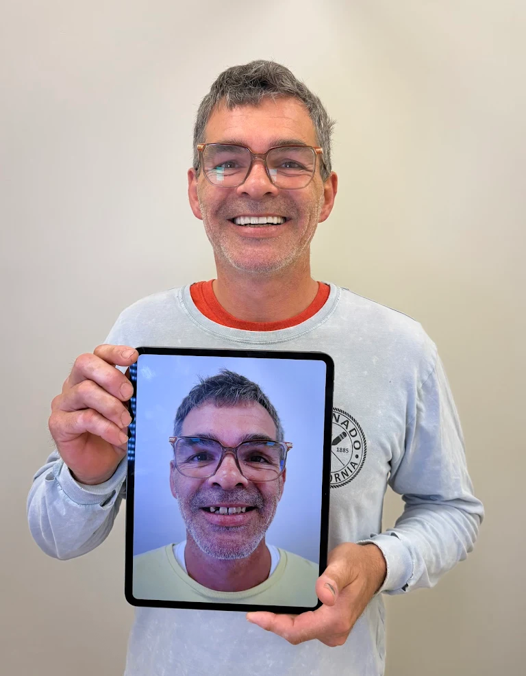 Premier-Smile-Pawleys-Gallery-9.png