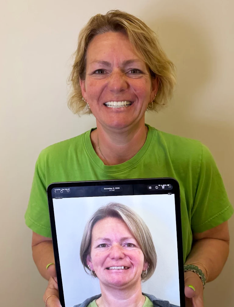 Premier-Smile-Pawleys-Gallery-2.png