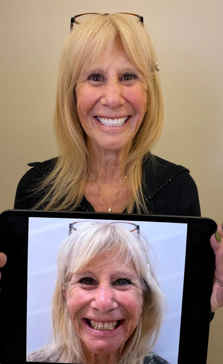 Premier-Smile-Pawleys-Gallery-18.png