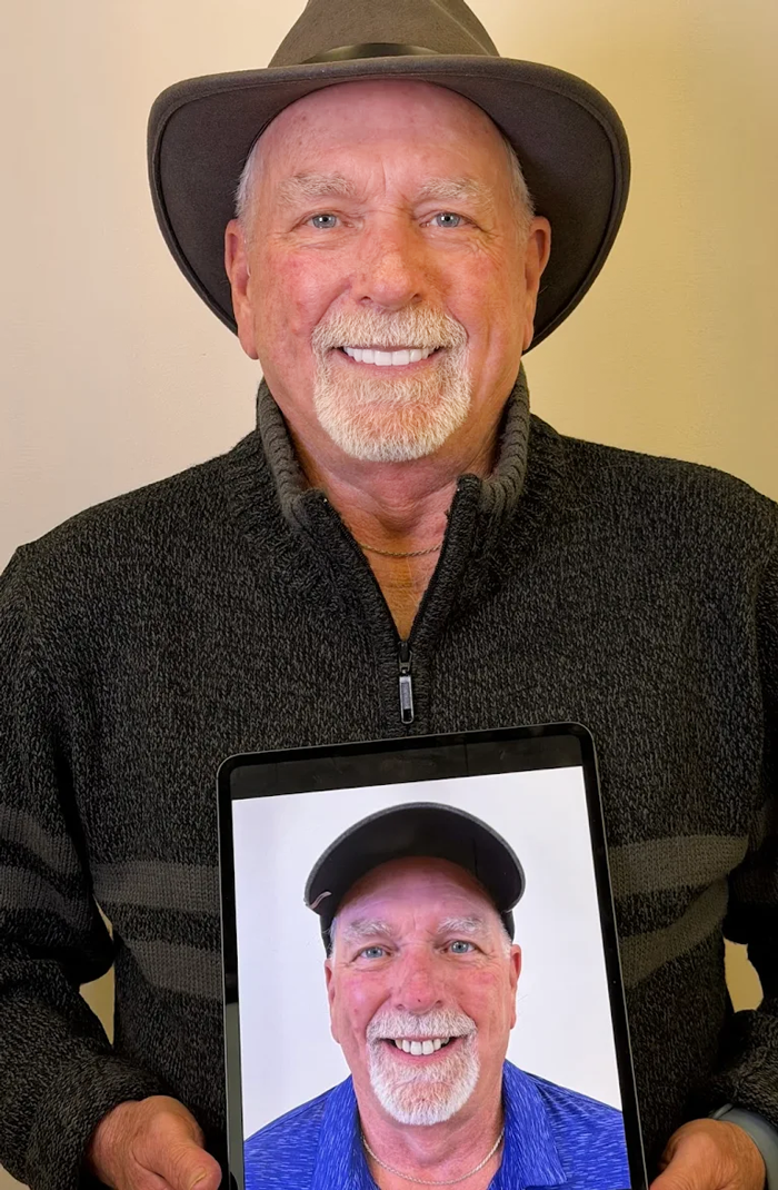 Premier-Smile-Pawleys-Gallery-13.png
