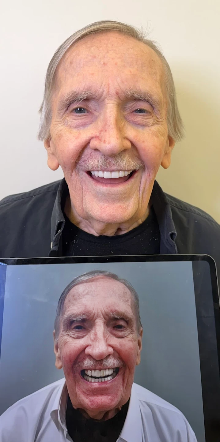 Premier-Smile-Pawleys-Gallery-10.png