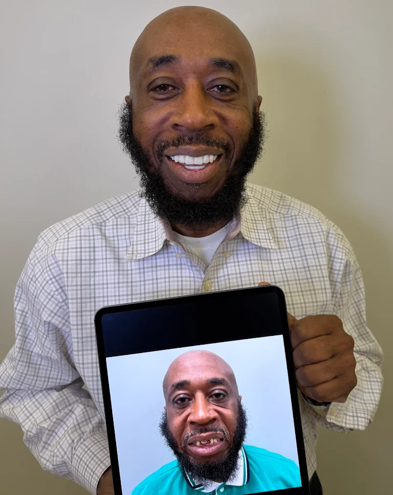 Premier-Smile-Pawleys-Gallery-17.png