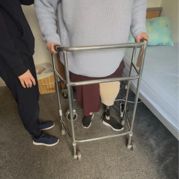 Read more about our amputee rehabilitation service