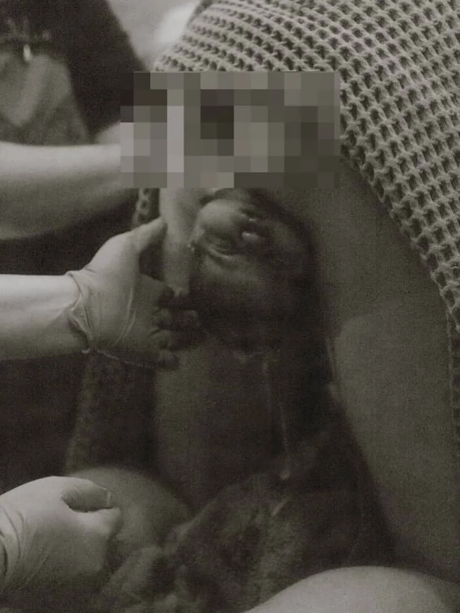 Often there&rsquo;s a natural pause between the birth of the baby&rsquo;s head and body &mdash; a sacred moment where baby rotates and the body prepares for the final emergence.

This pause is normal and physiologic. The baby is still receiving oxyge