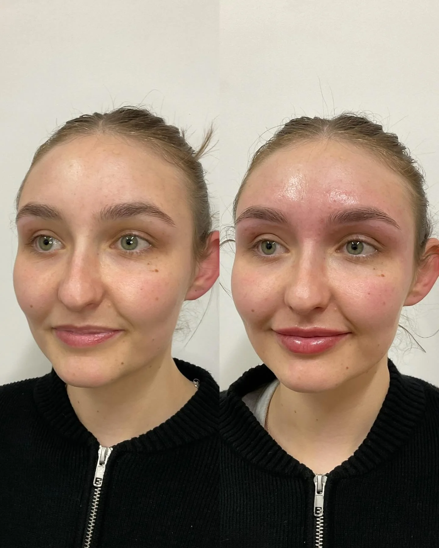 Complimentary brow wax &amp; tint for these two beauties ✨

Refer a friend who&rsquo;s new to the clinic and they&rsquo;ll receive $25 off their first treatment, and you&rsquo;ll get $25 credit on your file to use anytime 💵

📍168 Main St, Morningto