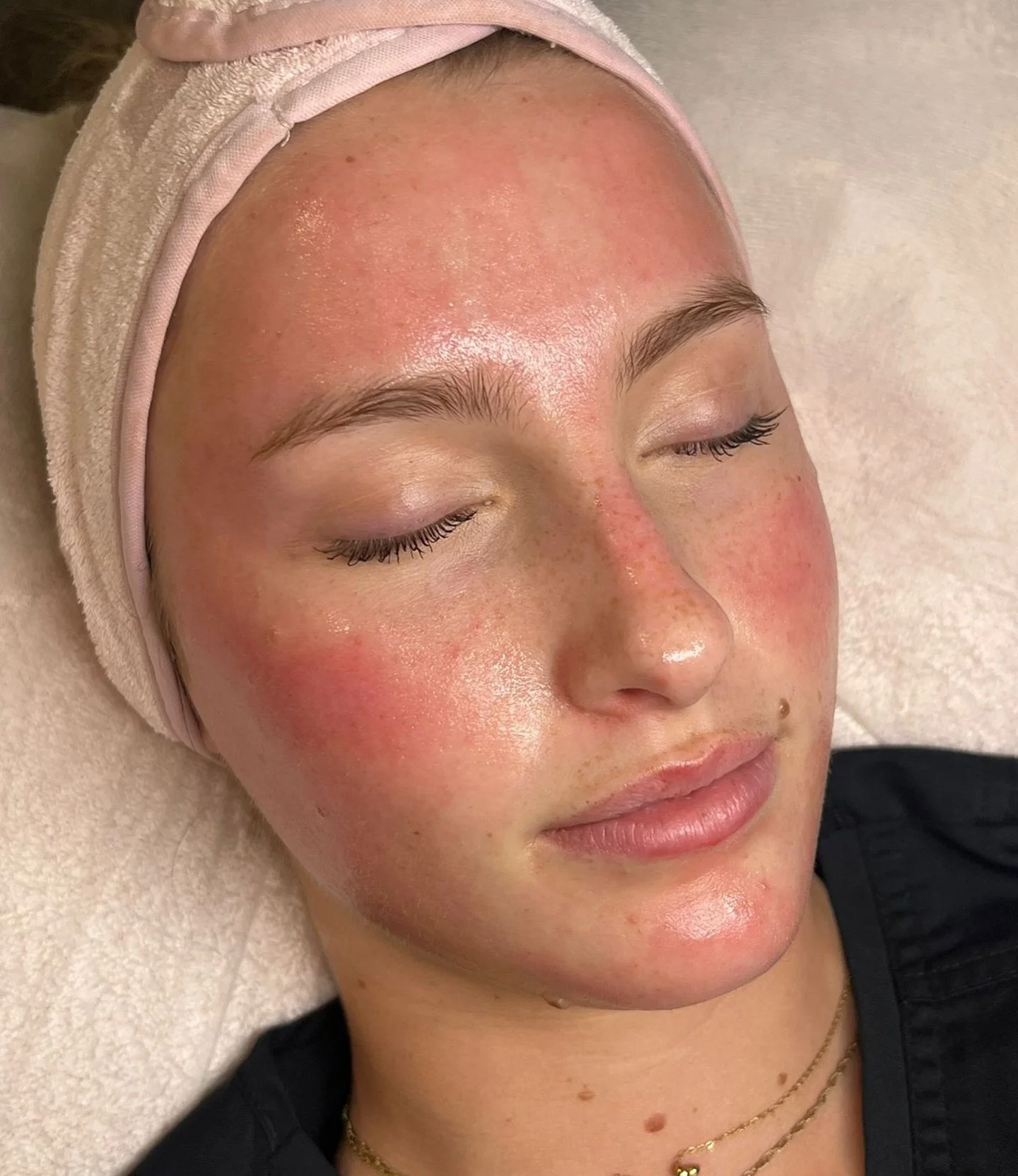 NEW TREATMENT ALERT‼️

Meet LuminFusion ✨

LuminFusion is a 45-minute skin treatment designed to deliver serious glow. It combines advanced exfoliation with nanoneedling technology (tiny, ultra-fine needles that painlessly create micro-channels in th
