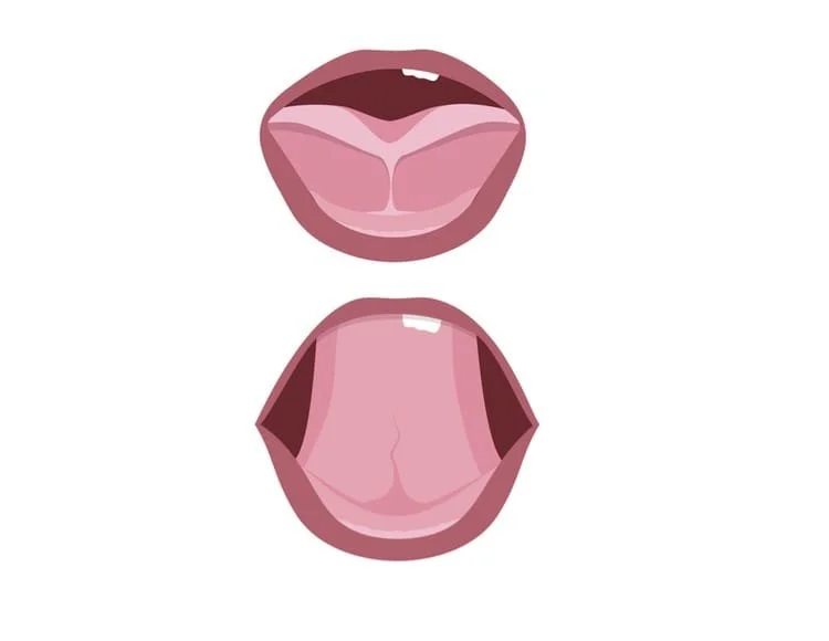 Illustration von zwei geöffneten Mündern mit Zunge zur Darstellung der Zungenbändchen-Behandlung.