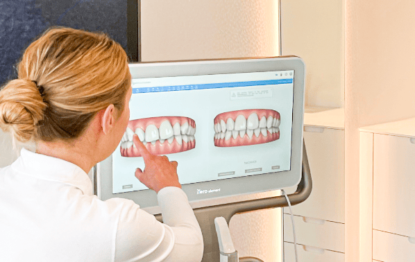 Zahnärztin analysiert 3D-Modell am Bildschirm – individuelle Planung der Aligner-Therapie