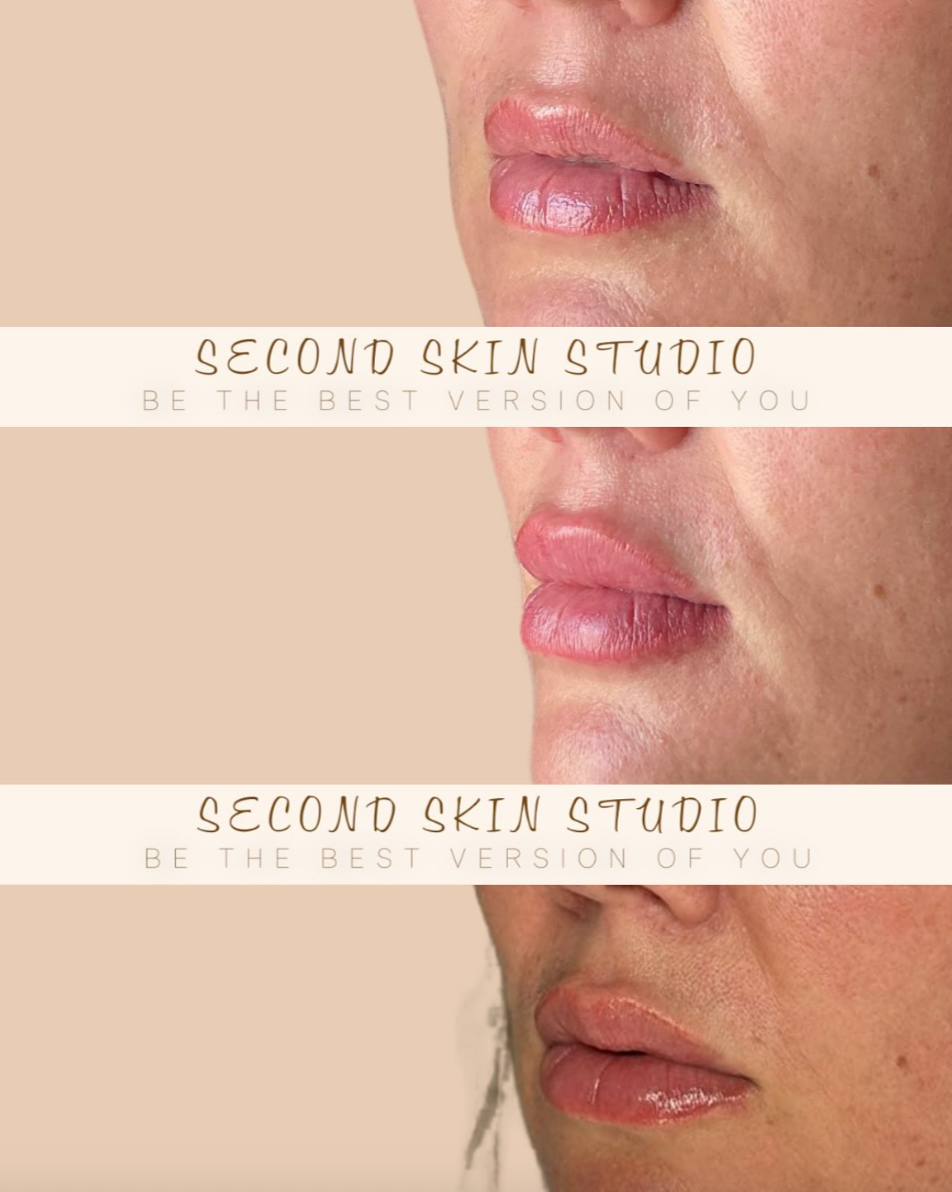 Close-up of a woman's lips and skin with text overlay promoting Second Skin Studio, a skincare business.