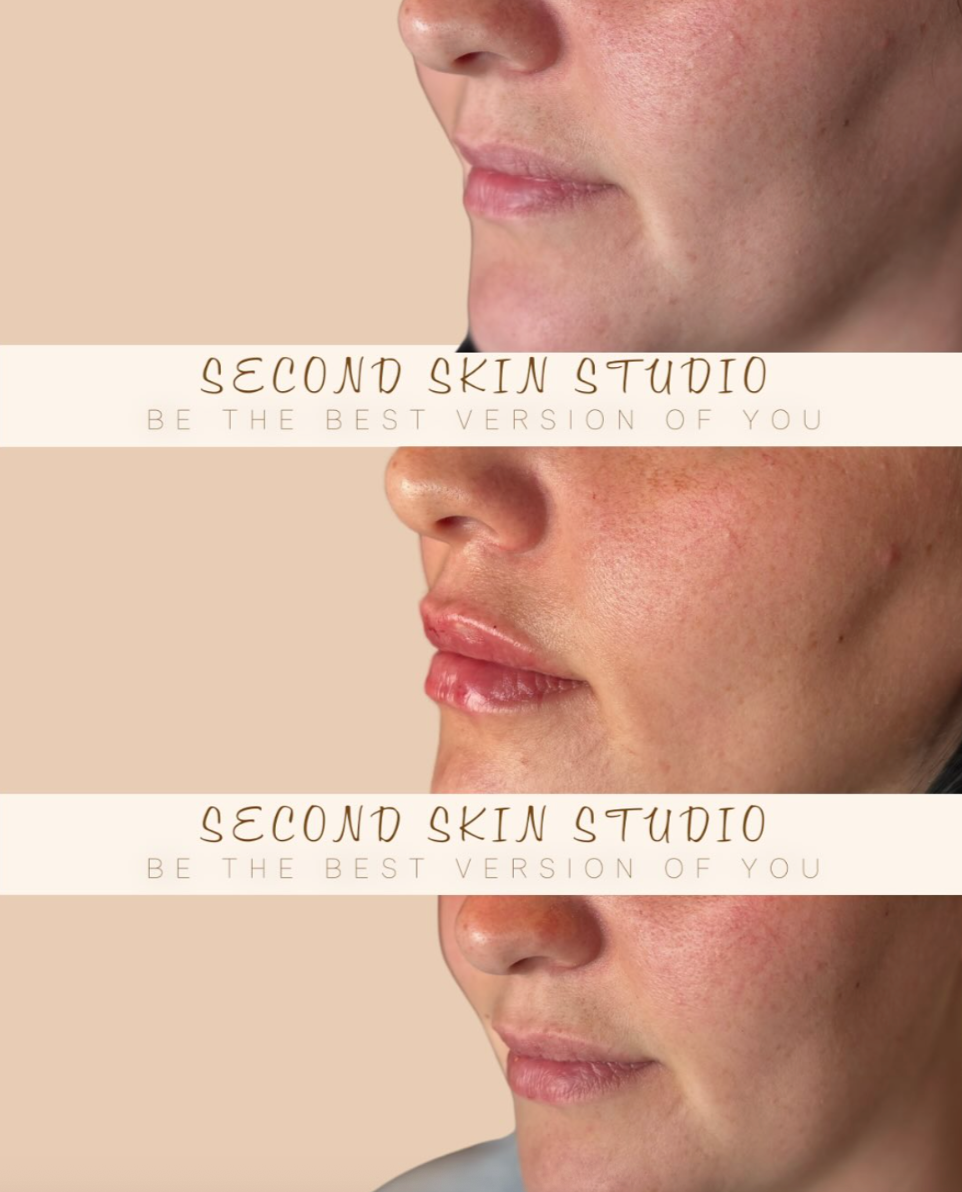 Close-up images of a person's face showing before and after skin treatments, with the text 'Second Skin Studio' and 'Be the best version of you' overlayed.