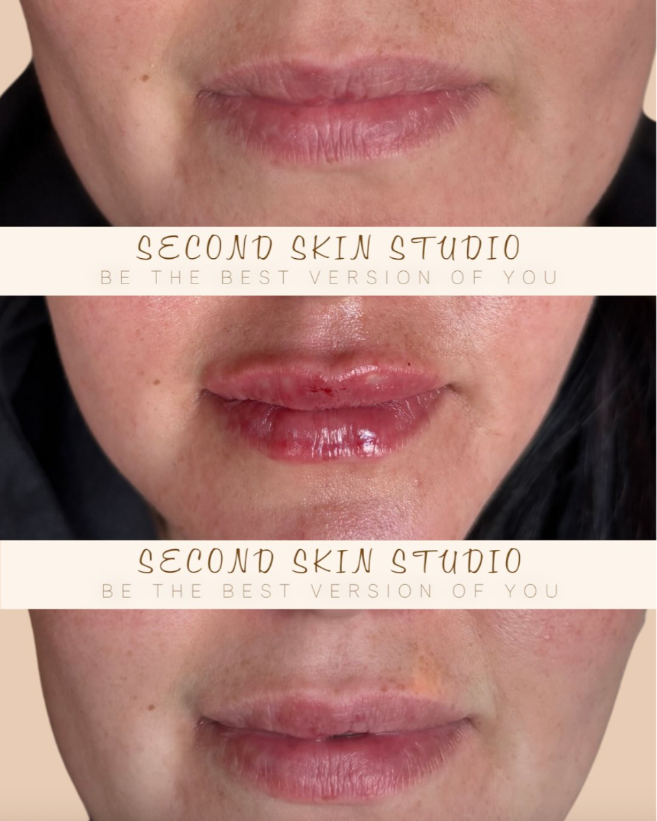Close-up images of lips showing a before, during, and after of skincare treatment with the text 'Second Skin Studio' and 'Be the best version of you' in between.