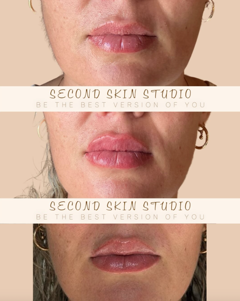 Close-up comparison of lips before and after skincare treatment, with text overlay reading 'Second Skin Studio' and 'Be the best version of you' repeated three times.
