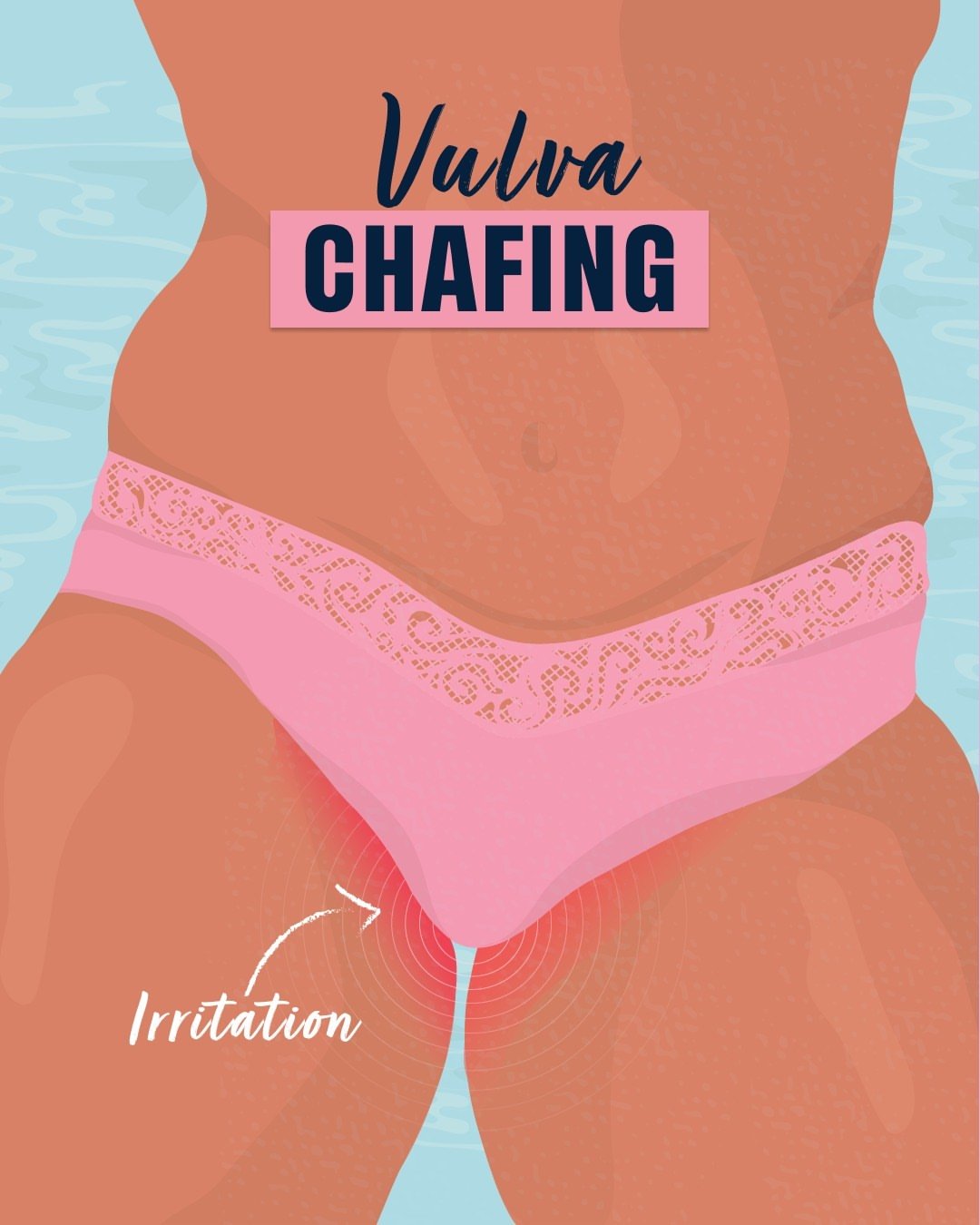 Vulva Chafing.jpg