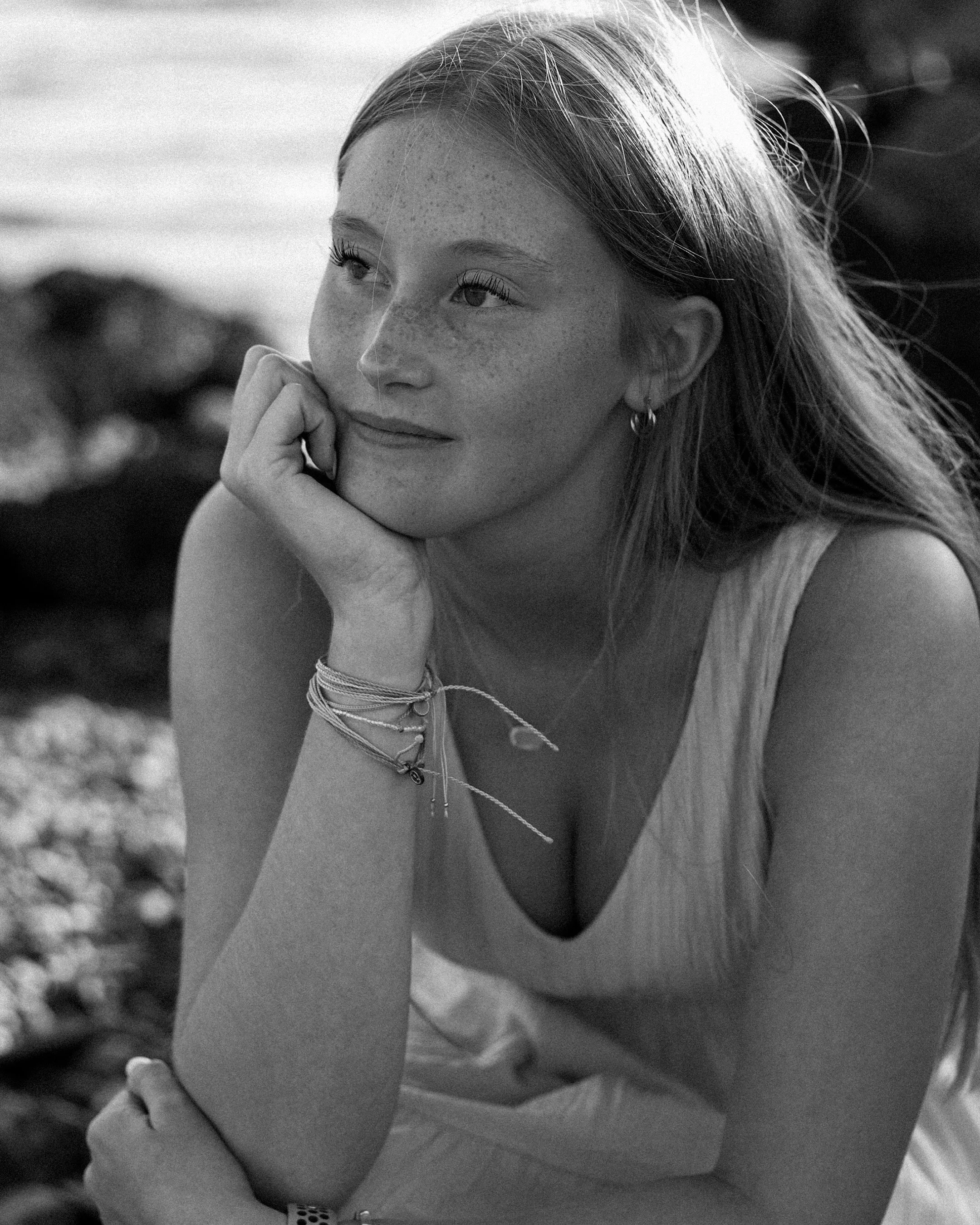A black and white photo of a young woman with freckles, resting her chin on her hand, looking thoughtfully into the distance.