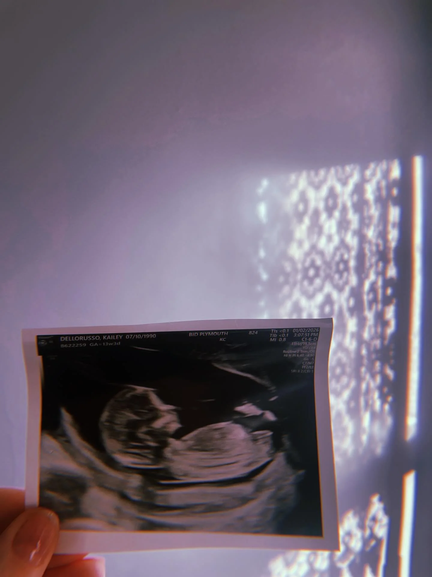 Baby girl coming this July 🎀🥹💗