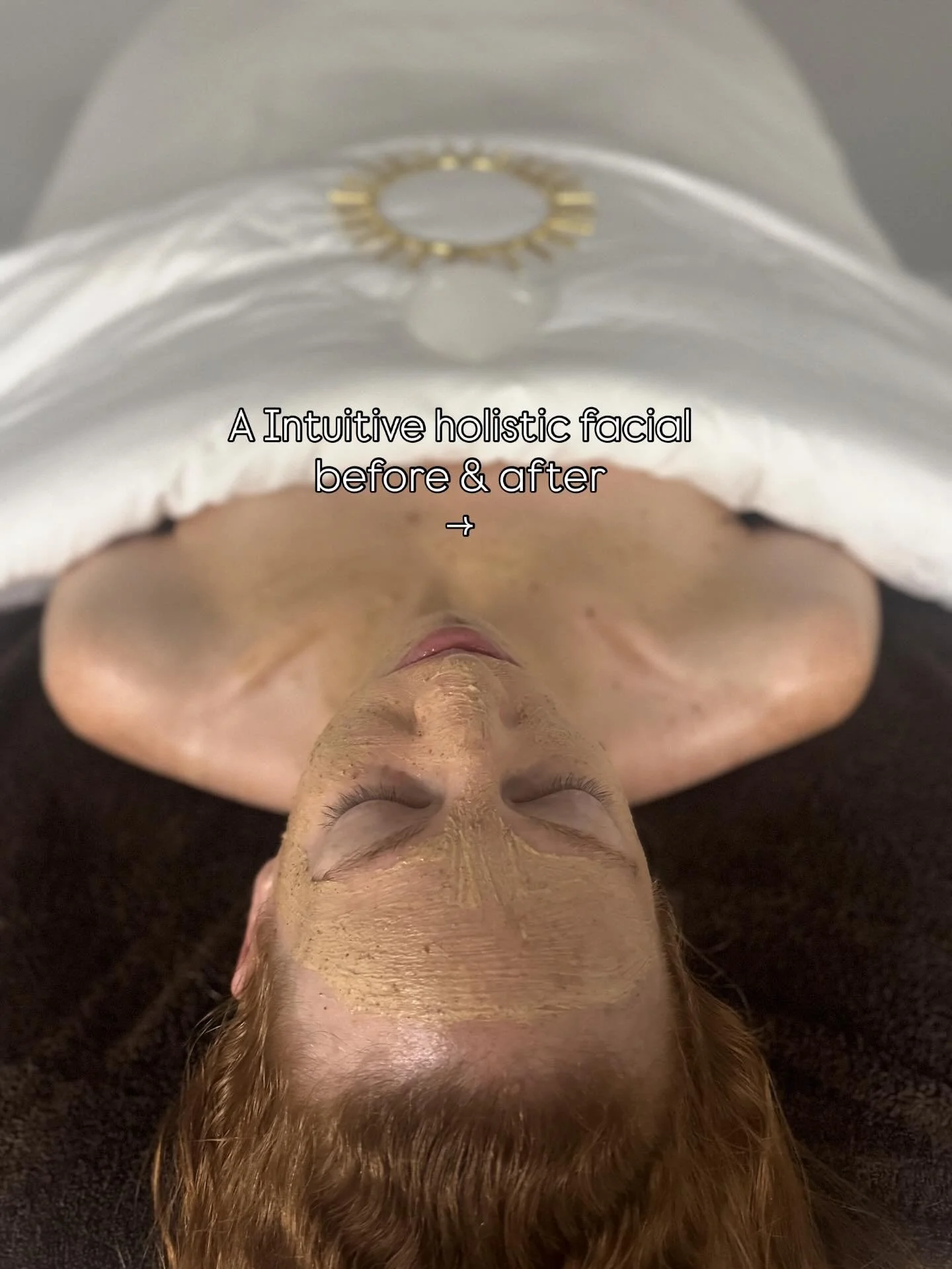 ✨ Before &amp; After &mdash; 3 Intuitive Holistic Facials ✨

This radiant transformation came from a series of three customized Intuitive Holistic Facials &mdash; blending plant-based peels, facial reflexology, cupping, sculpting massage, and other i