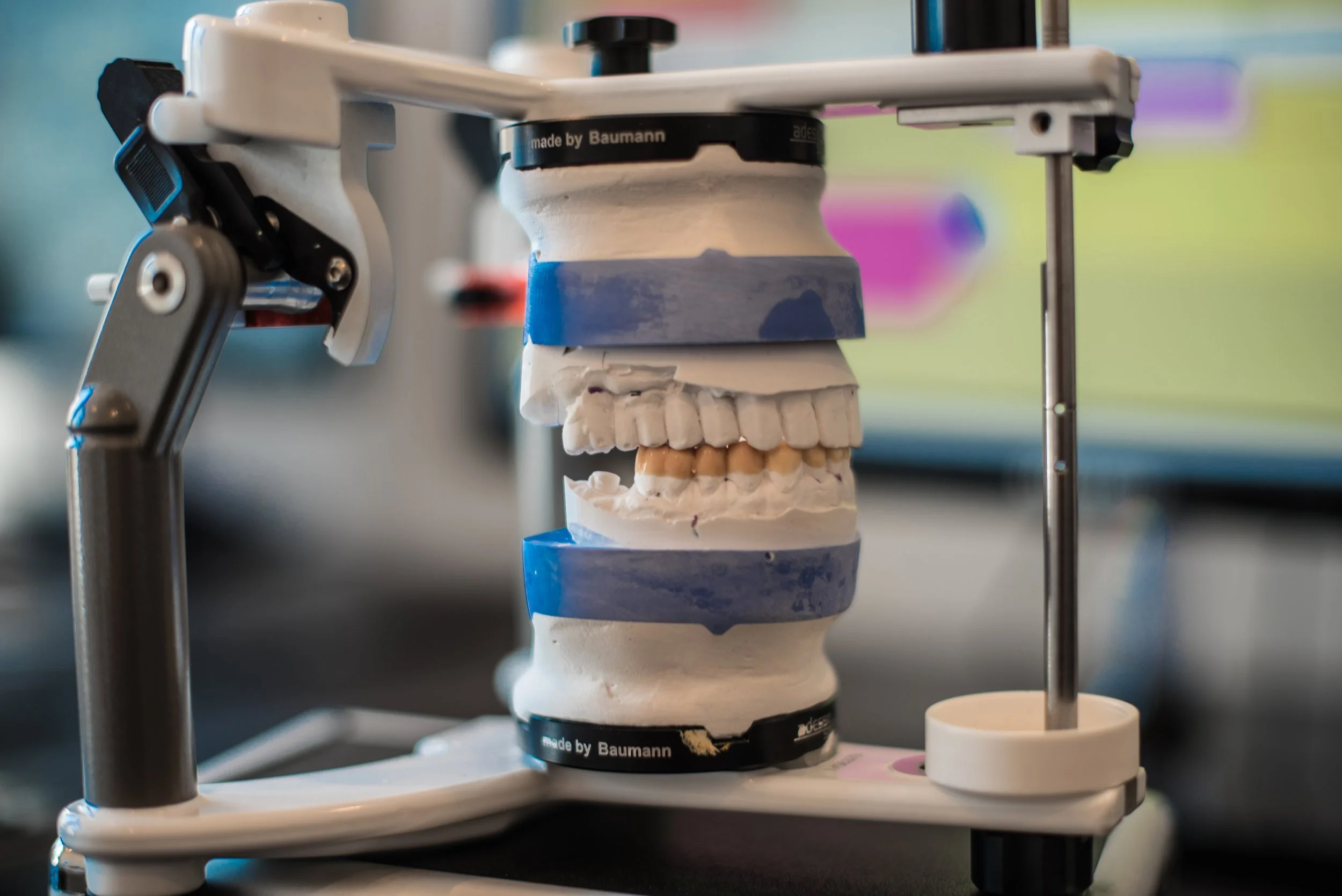 Dental articulator with a mounted model, showcasing precise bite alignment and jaw function analysis