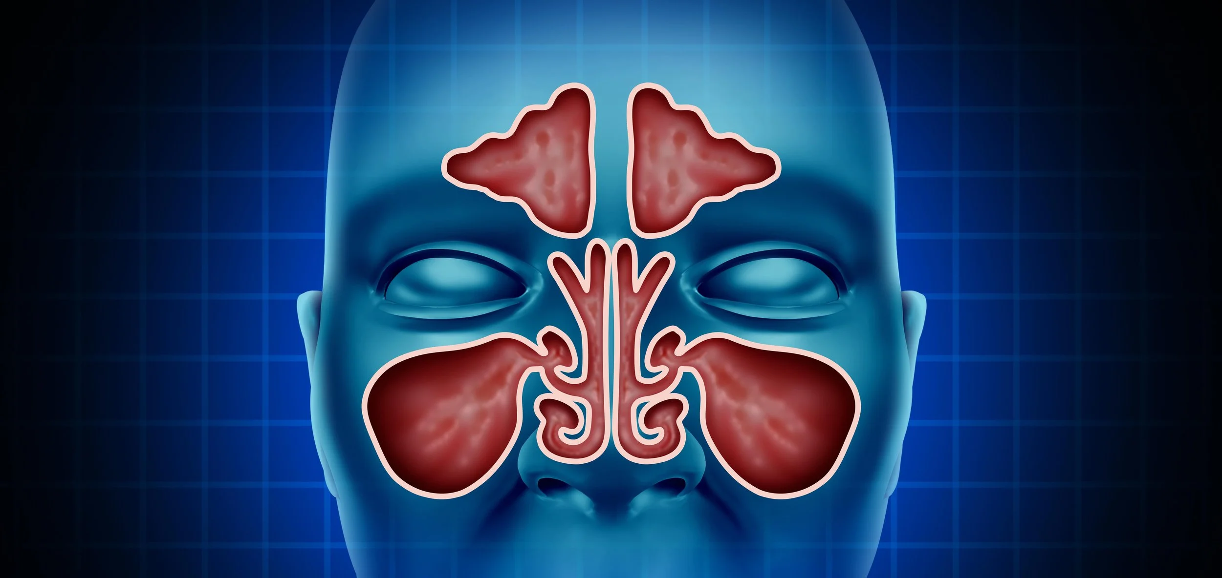 Illustration of sinus cavities over facial image