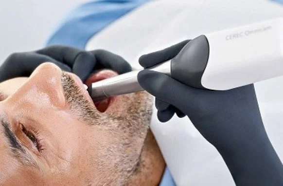 Close-up of a patient being scanned with the CEREC wand at Kaufman Dental Associates for precise crown design