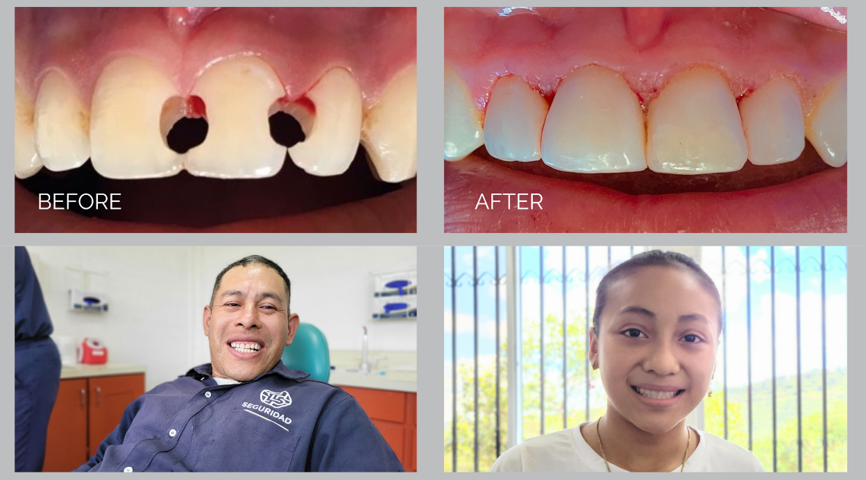 Smiles Restored - Lives Transformed