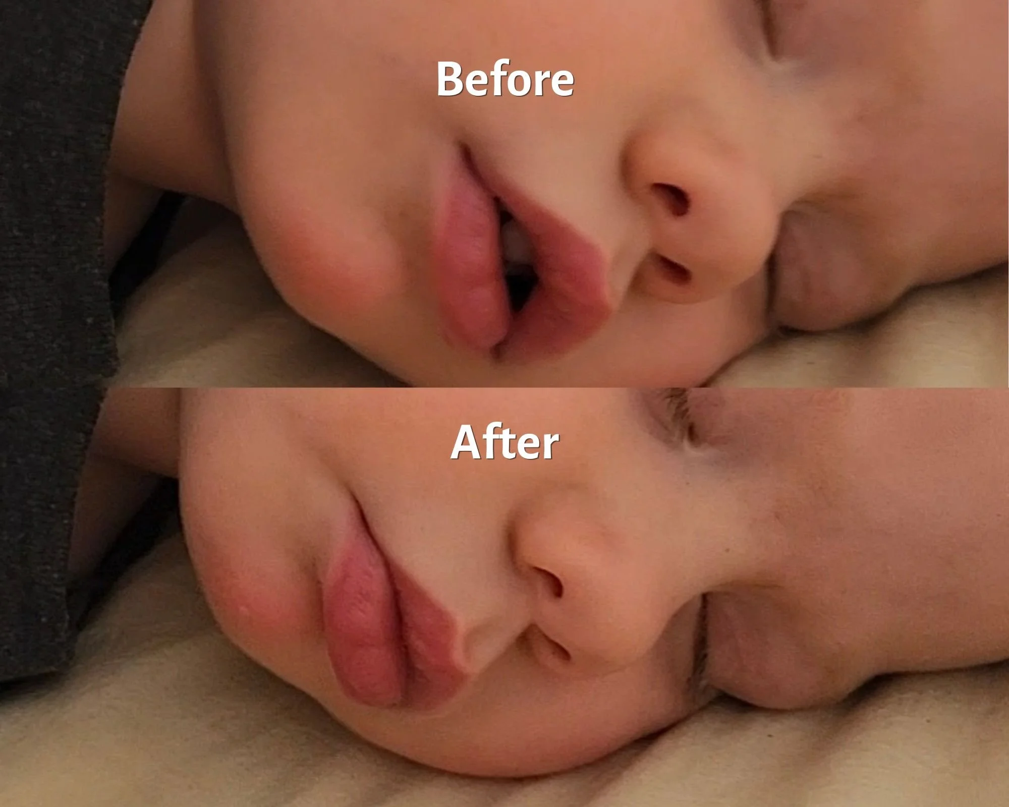 How To Get Baby’s Tongue On The Roof of The Mouth for Proper Tongue Resting Posture &amp; Nasal Breathing