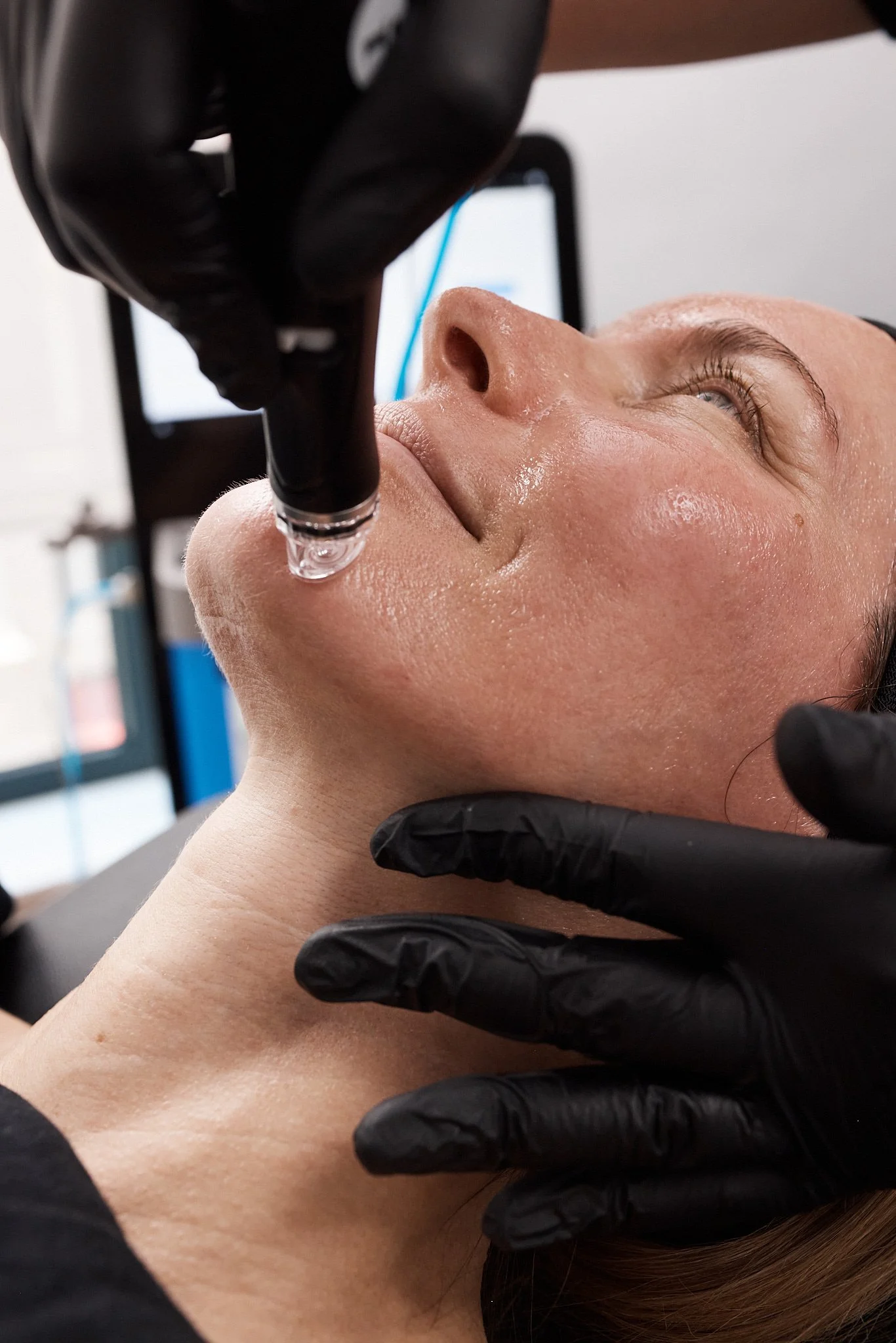 A woman receiving a facial treatment with a black device being applied to her face in a beauty clinic.
