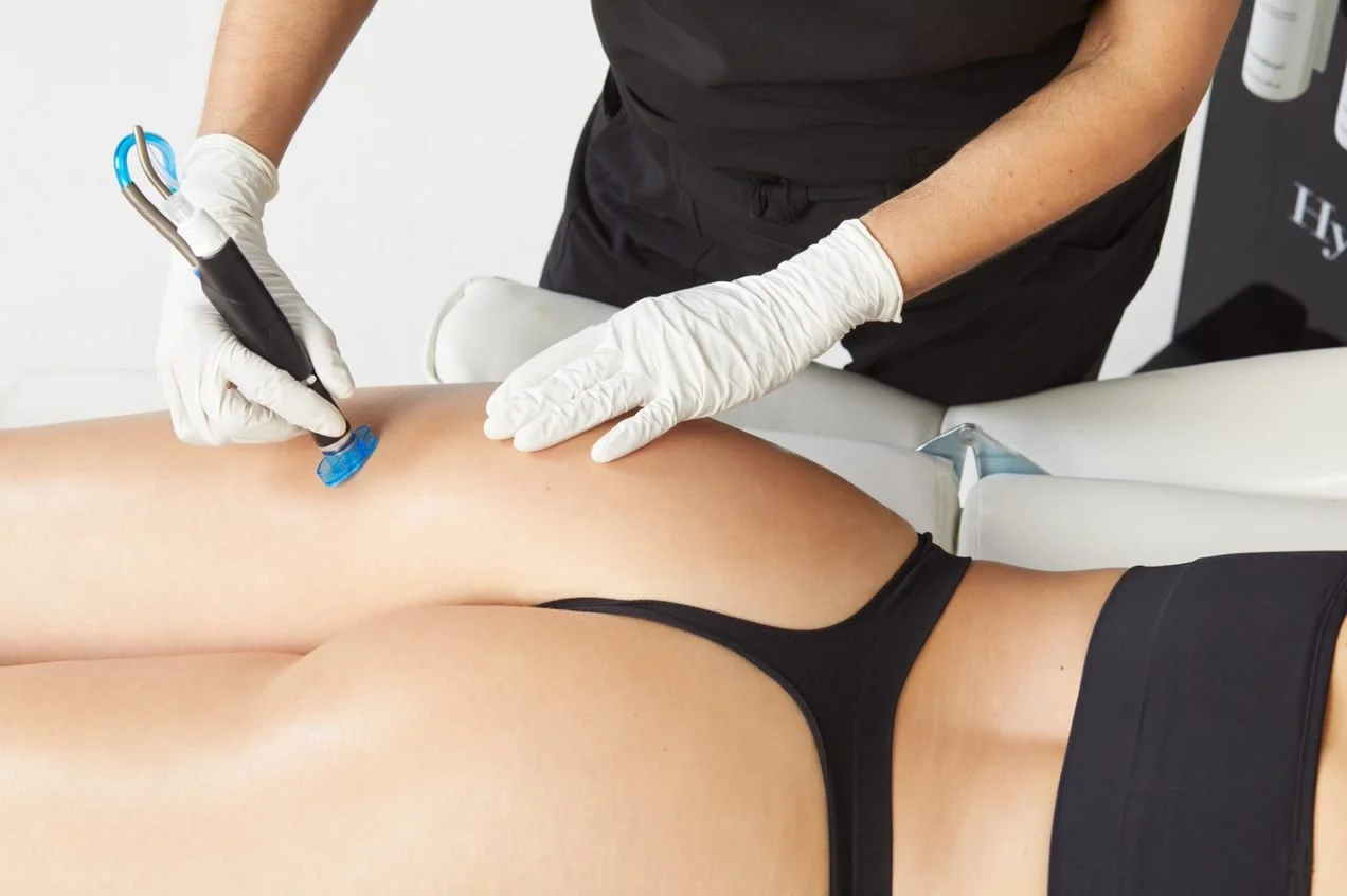 A person receiving a cosmetic treatment on their thigh with a medical device, while lying on a treatment table, wearing black underwear, and a professional wearing gloves administering the procedure.