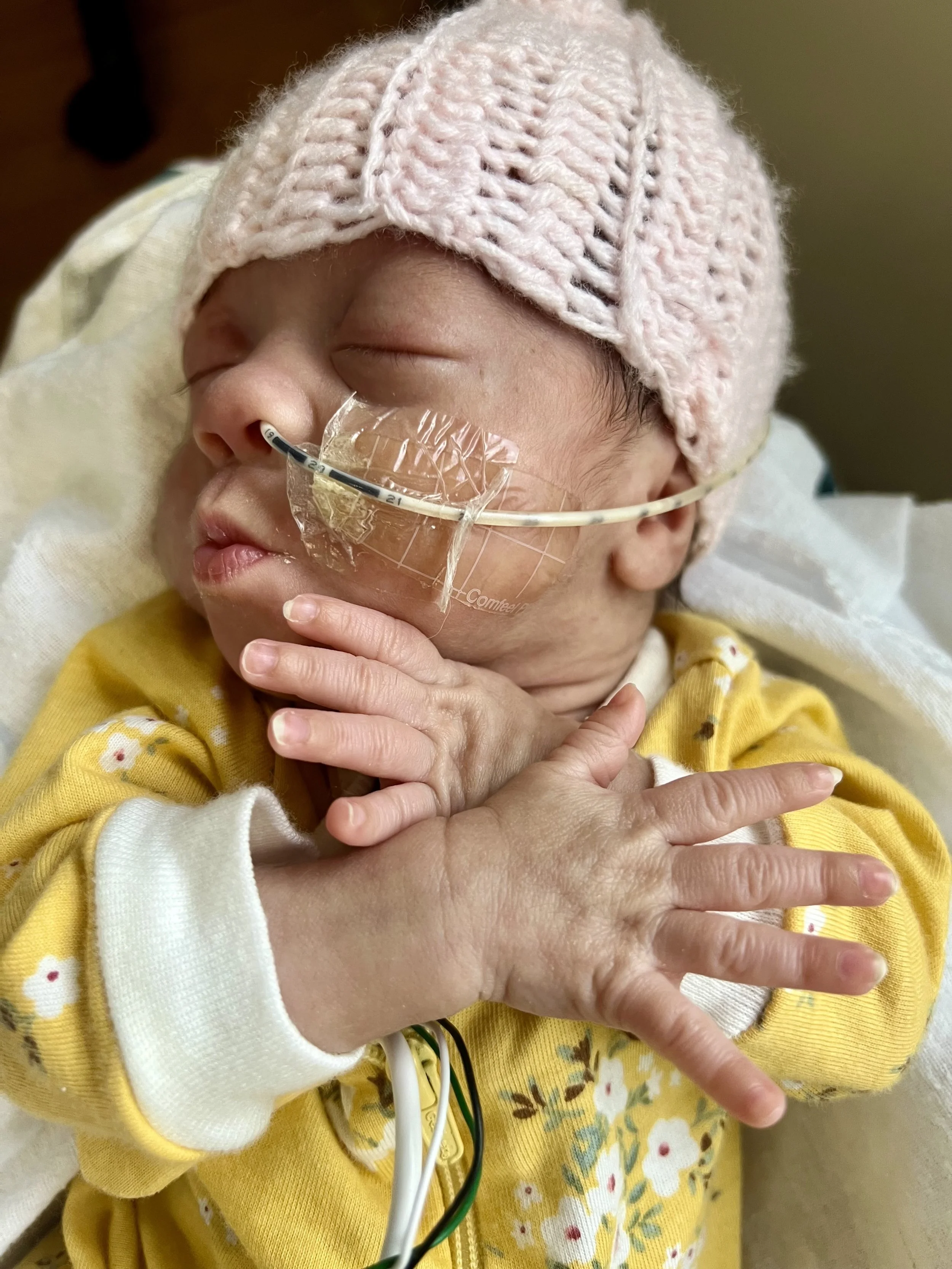 Newborn in a pink knit hat, yellow floral outfit, with a nasal feeding tube and hands gently crossed on their chest.
