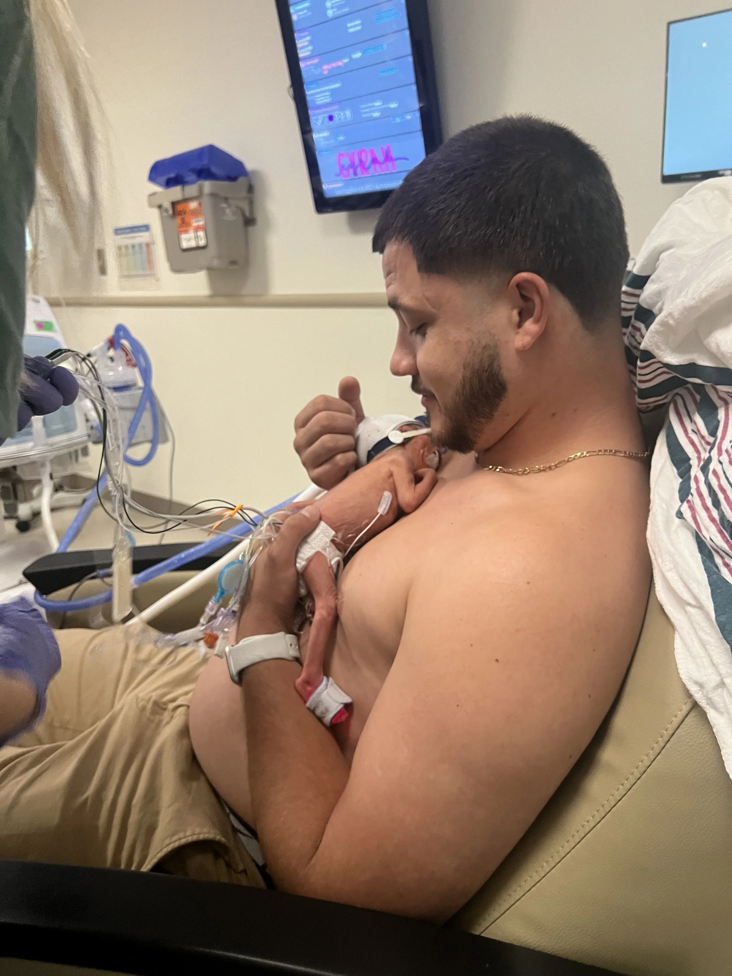 A man holds a tiny premature baby to his bare chest in a hospital room, providing skin-to-skin contact.