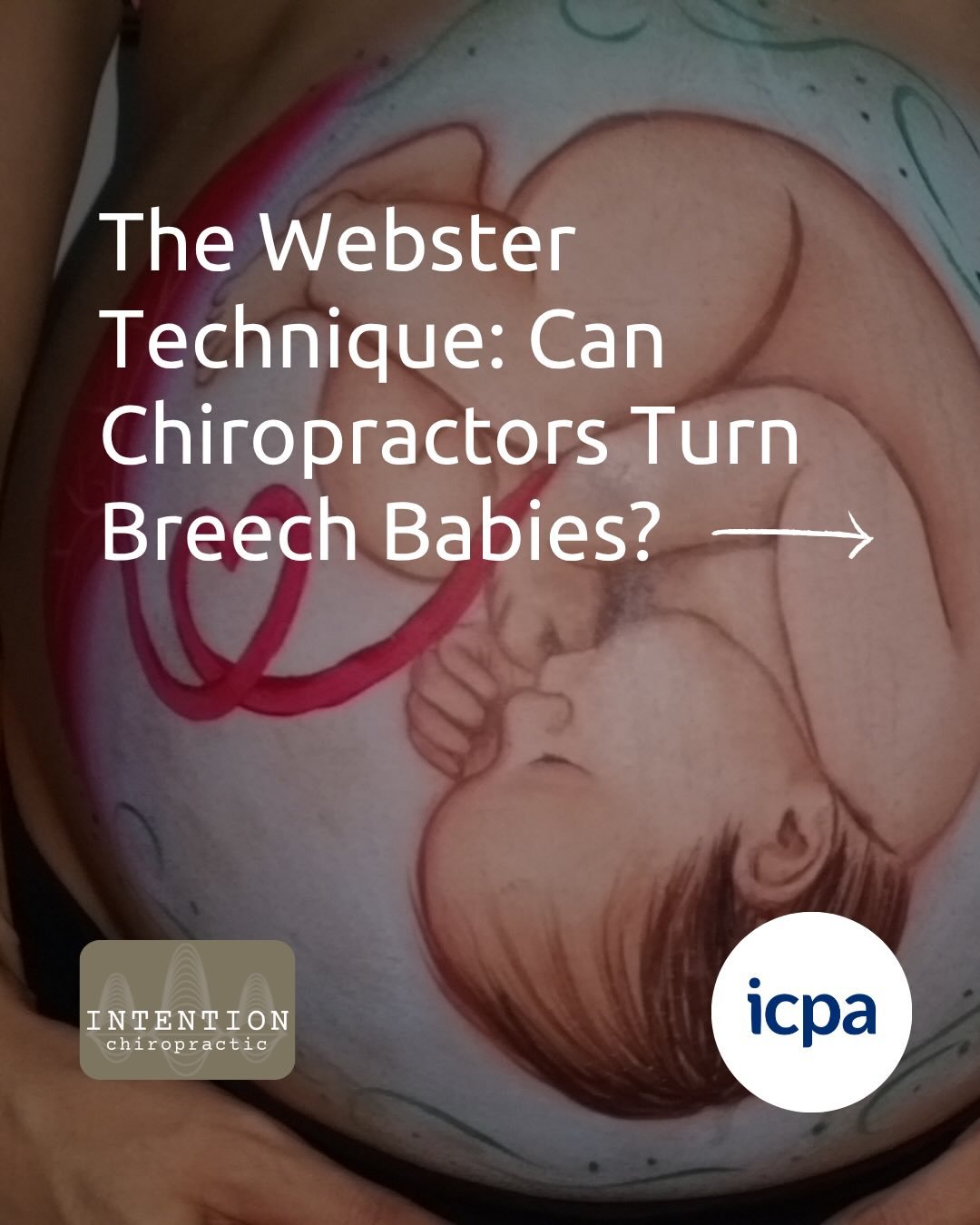 Your baby is already so smart! 🤓

Without any outside help, they&rsquo;ve spent months perfectly crafting their own body. That same innate intelligence is what guides them during labor and birth. But sometimes, a crowded or misaligned environment ma