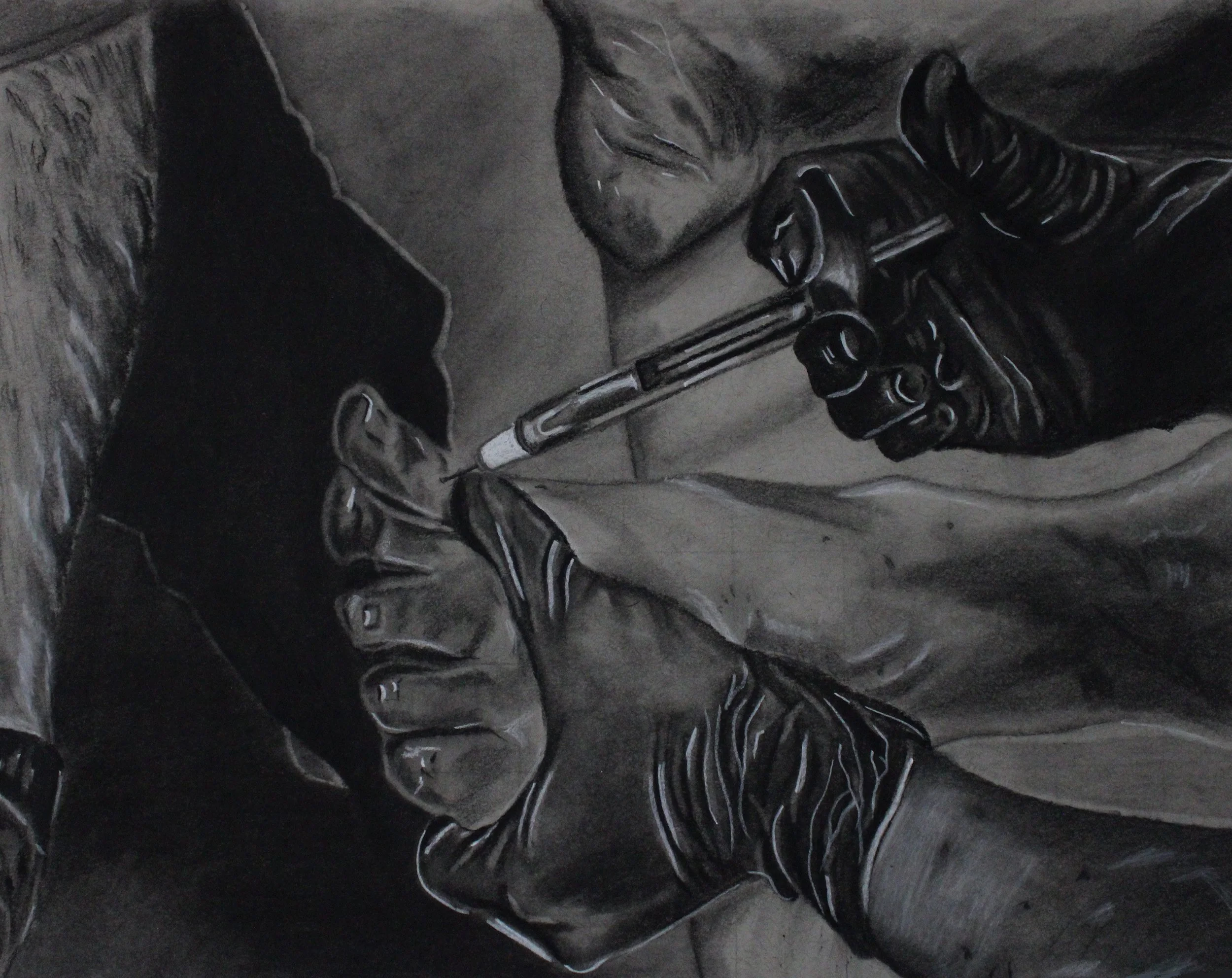 Lidocaine Between Metatarsals | 9 x 12 in | Charcoal on Gray Paper | 2026
