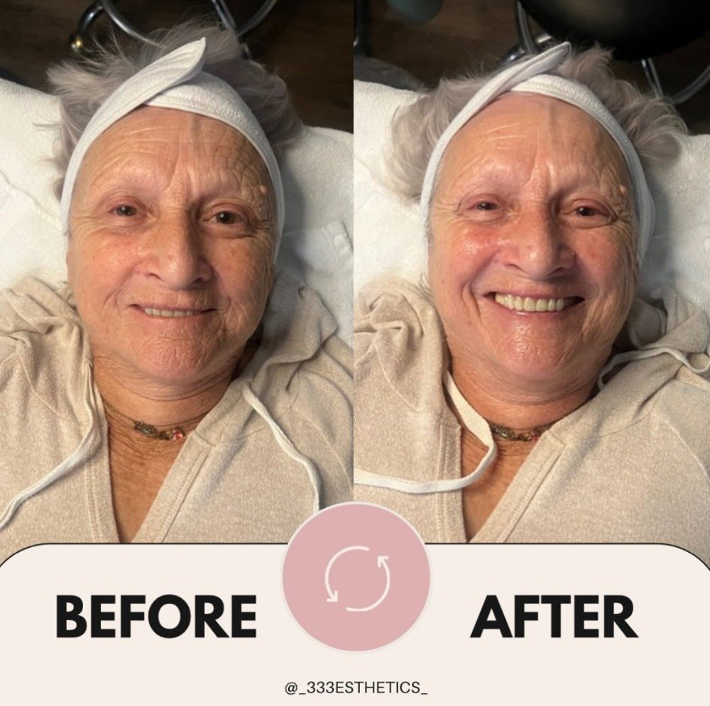 CUSTOM FACIAL using a variety of Image Skincare MAX products.
