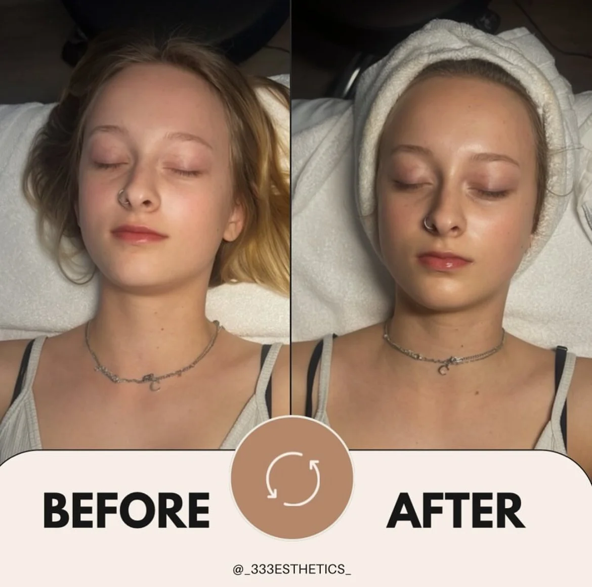 CUSTOM FACIAL treatment using a variety of Image skincare products for sensitive skin and allergies. 