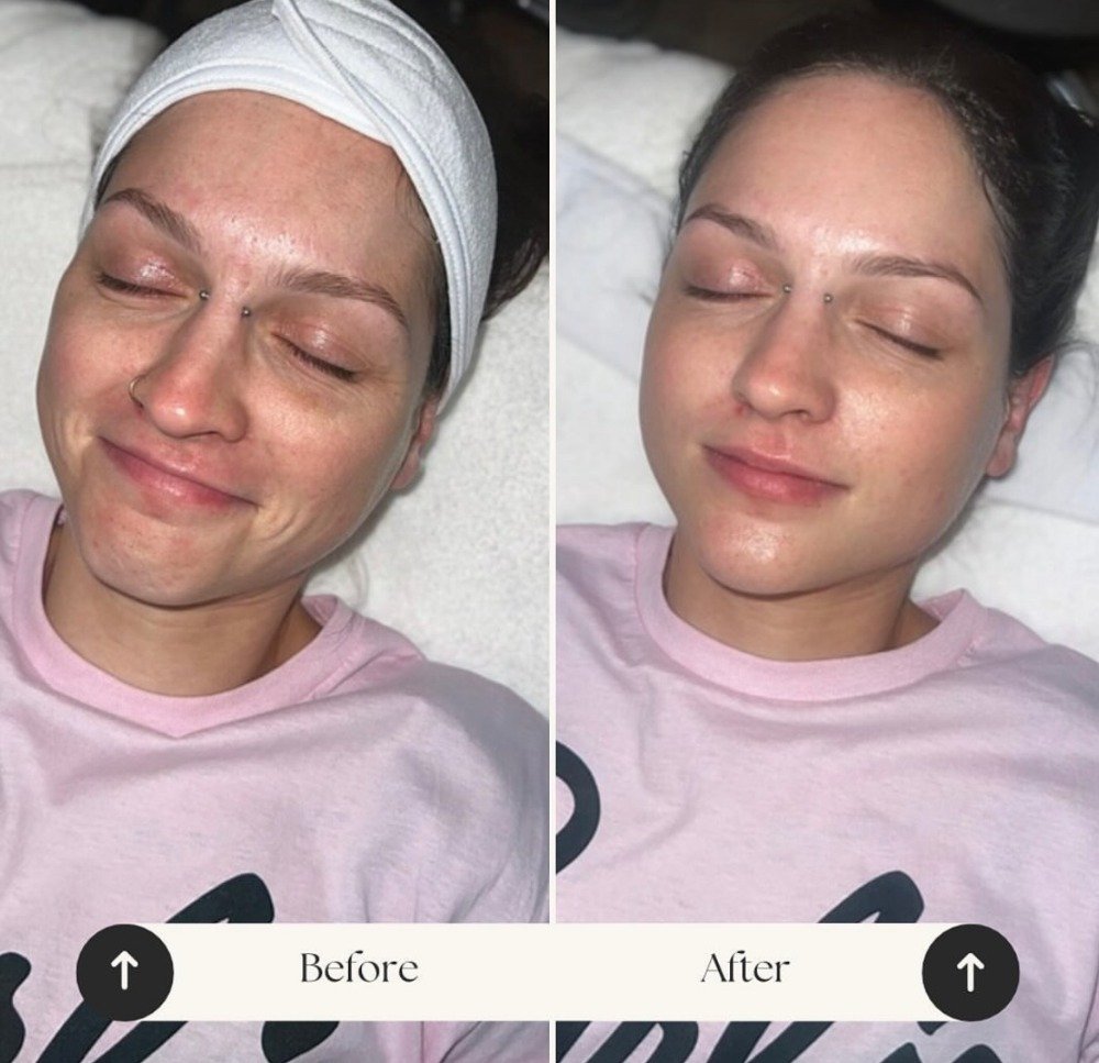 CUSTOM FACIAL treatment using a variety of Image Skincare products, including the ILUMA line.