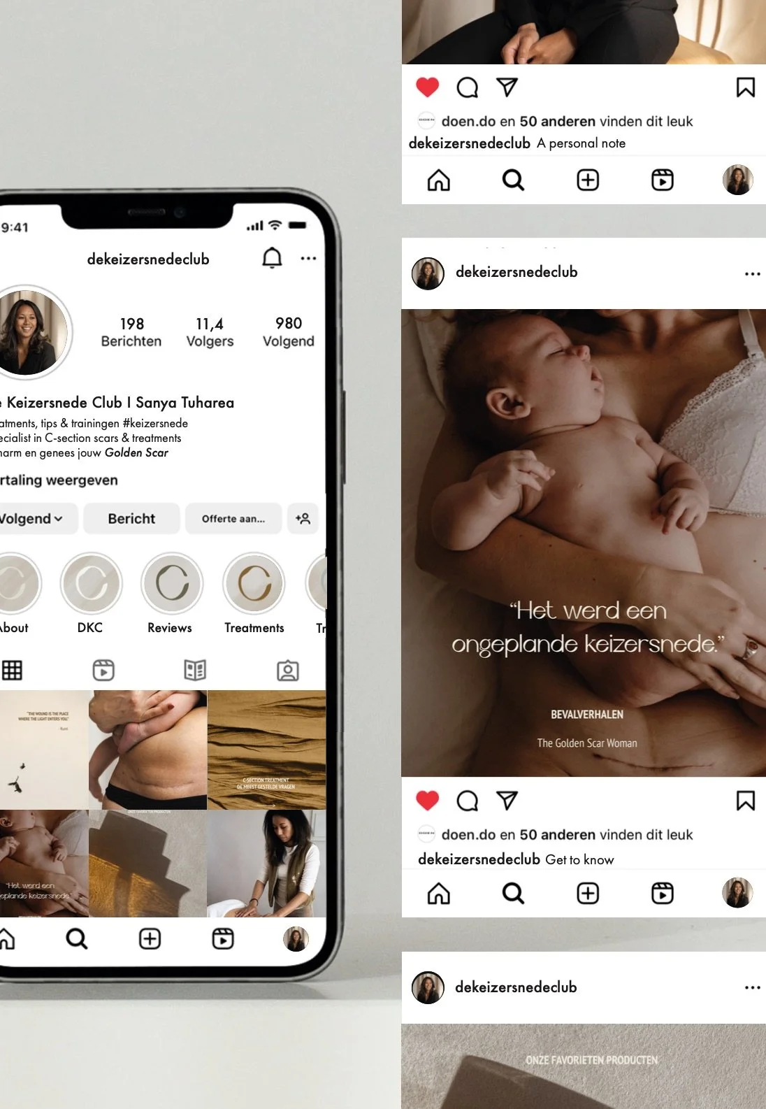 Collage of social media posts and a phone screen showcasing content related to a personal note about a healing process involving a cesarean scar, including images of a newborn, a woman, and related treatments and reviews.